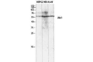 Western Blotting (WB) image for anti-V-Akt Murine Thymoma Viral Oncogene Homolog 1 (AKT1) (Ser134) antibody (ABIN3173743) (AKT1 antibody  (Ser134))