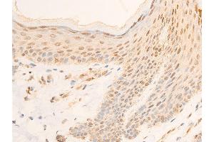 Immunohistochemistry (IHC) image for anti-Nuclear Factor of kappa Light Polypeptide Gene Enhancer in B-Cells Inhibitor, alpha (NFKBIA) (pSer32), (pSer36) antibody (ABIN6256292)