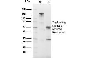 SDS-PAGE Analysis Purified CD10 Mouse Monoclonal Antibody (MME/2590). (MME antibody  (AA 297-483))