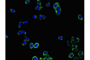 Immunofluorescent analysis of HepG2 cells using ABIN7172023 at dilution of 1:100 and Alexa Fluor 488-congugated AffiniPure Goat Anti-Rabbit IgG(H+L)