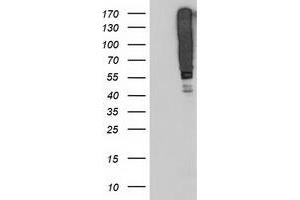 SERPINB13 antibody