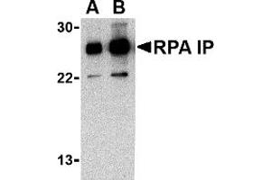 Western Blotting (WB) image for anti-RPA Interacting Protein (RPAIN) (C-Term) antibody (ABIN1030628) (RPAIN antibody  (C-Term))