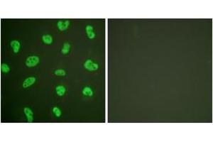 Immunofluorescence analysis of HeLa cells, using DNA-PK Antibody.