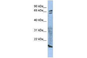 WB Suggested Anti-ZP1 Antibody Titration: 0. (ZP1 antibody  (Middle Region))