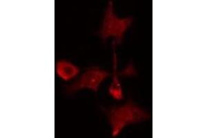 ABIN6275218 staining  Hela cells by IF/ICC. (MAD2L1BP antibody  (N-Term))