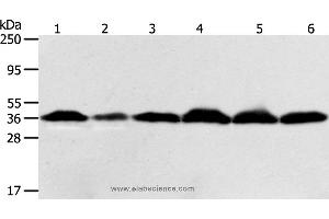 Western blot analysis of Hela cell and human liver cancer tissue, Raji, Jurkat, 293T and PC3 cell, using APEX1 Polyclonal Antibody at dilution of 1:450