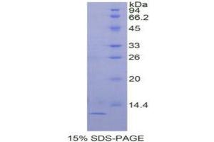 SDS-PAGE analysis of Human TGFa Protein. (TGFA Protein)