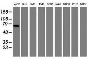 Image no. 2 for anti-alpha-Fetoprotein (AFP) antibody (ABIN1496491) (alpha Fetoprotein antibody)