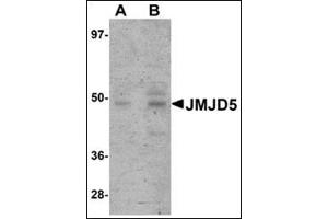 Western blot analysis of JMJD5 in human liver tissue lysate with this product at (A) 1 and (B) 2 μg/ml. (JMJD5 antibody  (C-Term))