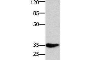 Western Blot analysis of Mouse muscle tissue using HOXA11 Polyclonal Antibody at dilution of 1:350 (Homeobox A11 antibody)
