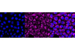 anti-Reticulon 4 (RTN4) antibody