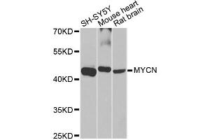 Western blot analysis of extracts of various cell lines, using MYCN antibody (ABIN5970179) at 1/1000 dilution. (MYCN antibody)