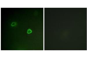 Immunofluorescence analysis of COS7 cells, using p90 RSK (Phospho-Thr573) antibody. (RPS6KA3 antibody  (pThr573))