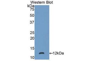 Western Blotting (WB) image for anti-S100 Calcium Binding Protein P (S100P) (AA 1-95) antibody (ABIN3205546) (S100P antibody  (AA 1-95))