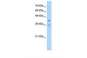 Image no. 1 for anti-Transmembrane Protein 104 (TMEM104) (AA 158-207) antibody (ABIN387739) (TMEM104 antibody  (AA 158-207))