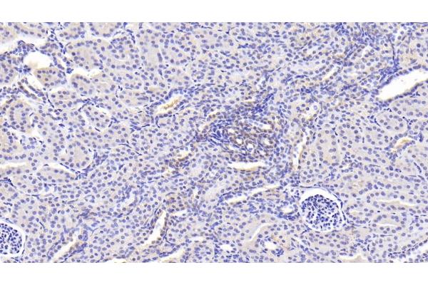 Permeability Glycoprotein antibody  (AA 1023-1280)