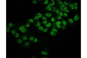 Immunofluorescence staining of Hela cells (treated with 30mM sodium butyrate for 4h) with ABIN7139151 at 1:2. (Histone H2B antibody  (acLys116))