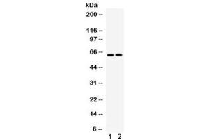 Western blot testing of 1) rat brain and 2) mouse brain lysate with SLC22A2 antibody. (SLC22A2 antibody)