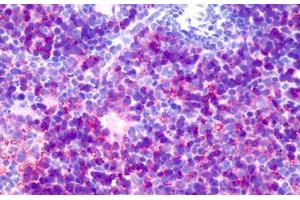 Mouse Spleen: Formalin-Fixed, Paraffin-Embedded (FFPE) (CD147 antibody)