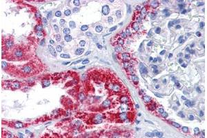 Human Kidney: Formalin-Fixed, Paraffin-Embedded (FFPE) (OCIAD2 antibody  (C-Term))