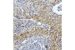 IHC analysis of EIF4A using anti-EIF4A antibody (ABIN7601309). (EIF4A1 antibody  (AA 32-406))
