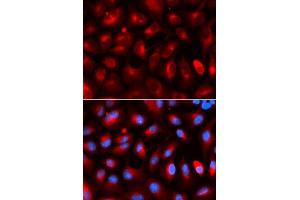 Immunofluorescence analysis of U2OS cells using KLC1 antibody. (KLC1 antibody  (AA 261-560))