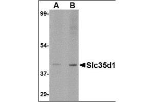 Western blot analysis of Slc35D1 inA-20 lysate with this product at (A) 1 and (B) 2 μg/ml. (SLC35D1 antibody  (N-Term))