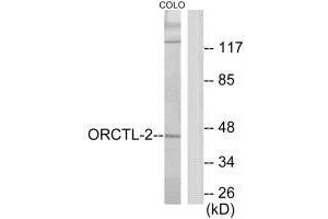 Western blot analysis of extracts from COLO205 cells, using ORCTL-2 antibody. (ORCTL-2/SLC22A18 antibody  (C-Term))