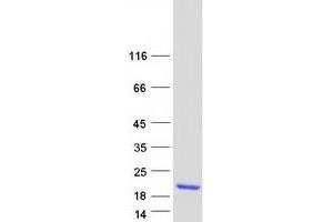 Validation with Western Blot