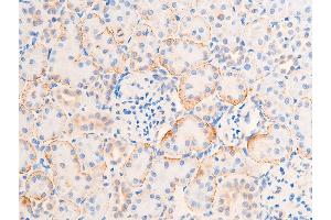 Immunohistochemistry (IHC) image for anti-Checkpoint Kinase 1 (CHEK1) (pSer317) antibody (ABIN6255201)
