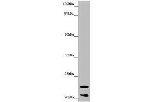 Western blot All lanes: CRYGS antibody at 6. (CRYGS antibody  (AA 1-178))