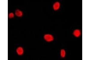 Immunofluorescent analysis of CBP20 staining in Hela cells.