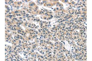 THSD1 antibody