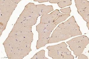Immunohistochemistry analysis of paraffin-embedded mouse skeletal muscle using SLC8A3 (ABIN7075684) at dilution of 1: 1600 (SLC8A3 antibody)