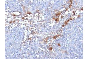 Image no. 3 for anti-Melanoma Cell Adhesion Molecule (MCAM) antibody (ABIN6153528)