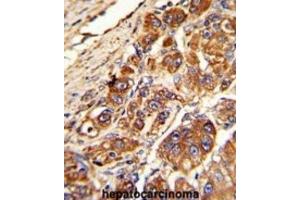 Immunohistochemistry (IHC) image for anti-Kinesin Light Chain 1 (KLC1) antibody (ABIN3003845) (KLC1 antibody)
