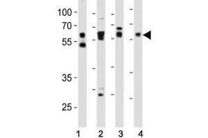 Western blot analysis of lysate from (1) HeLa, (2) mouse NIH3T3, (3) mouse C2C12, and (4) rat PC-12 cell line using SMAD2 antibody at 1:1000. (SMAD2 antibody  (AA 198-232))