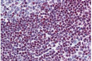 SFRS6 antibody  (AA 143-192)