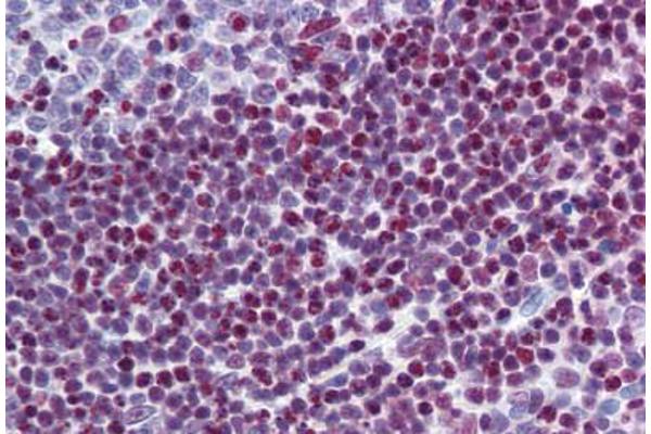 SFRS6 antibody  (AA 143-192)