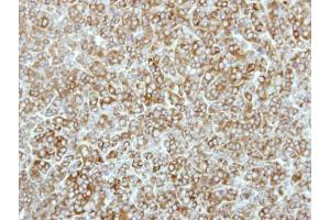 IHC-P Image Immunohistochemical analysis of paraffin-embedded BT483 xenograft, using eEF-2K, antibody at 1:500 dilution. (EEF2K antibody  (N-Term))