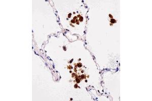 Paraformaldehyde-fixed, paraffin embedded Human lungtissue, Antigen retrieval by boiling in sodium citrate buffer (pH6. (FABP4 antibody)