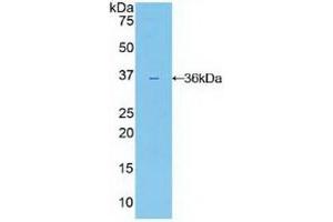 Detection of Recombinant IL22R, Human using Polyclonal Antibody to Interleukin 22 Receptor (IL22R)