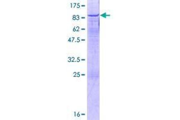 UTP18 Protein (AA 1-521) (GST tag)