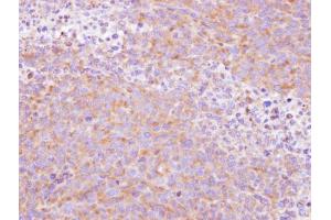 IHC-P Image Immunohistochemical analysis of paraffin-embedded H1299 xenograft , using SCY1 like 3, antibody at 1:500 dilution. (SCYL3 antibody  (Center))