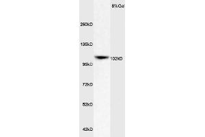Rat Brain lysates probed with Rabbit Anti-ApoER2 Polyclonal Antibody (ABIN719426) at 1:200 in 4 °C. (LRP8 antibody  (AA 851-963))