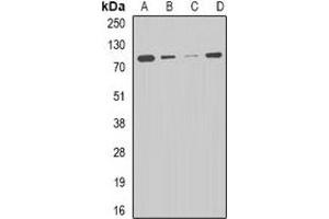 Western blot analysis of CPT2 expression in HepG2 (A), THP1 (B), mouse liver (C), mouse heart (D) whole cell lysates. (CPT2 antibody)