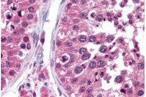 Human Testis (formalin-fixed, paraffin-embedded) stained with TEGT antibody ABIN290214 at 5 ug/ml followed by biotinylated anti-mouse IgG secondary antibody ABIN481714, alkaline phosphatase-streptavidin and chromogen. (Bax Inhibitor 1 antibody)