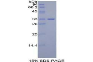 SDS-PAGE analysis of Mouse GLI3 Protein. (GLI Family Zinc Finger Protein 3 Protein)