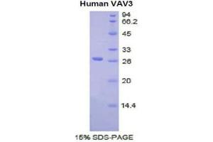SDS-PAGE (SDS) image for Vav 3 Oncogene (VAV3) (AA 183-380) protein (His tag) (ABIN1081160) (VAV3 Protein (AA 183-380) (His tag))