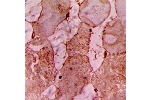 Immunohistochemical analysis of CARK staining in human heart formalin fixed paraffin embedded tissue section. (TNNI3K antibody  (Center))
